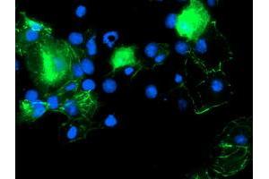 Anti-PDLIM2 mouse monoclonal antibody (ABIN2454449) immunofluorescent staining of COS7 cells transiently transfected by pCMV6-ENTRY PDLIM2 (RC210022). (PDLIM2 antibody)