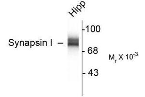 Image no. 2 for anti-Synapsin I (SYN1) antibody (ABIN372716) (SYN1 antibody)