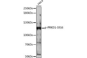 Western blot analysis of extracts of HeLa cells, using Phospho-PKC mu-S916 Rabbit pAb (ABIN7269642) at 1:1000 dilution. (PKC mu antibody  (pSer916))