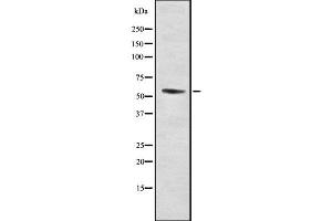 Western blot analysis of RMP using LOVO whole cell lysates (URI1 antibody  (Internal Region))
