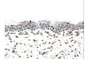 FTCD antibody was used for immunohistochemistry at a concentration of 4-8 ug/ml.