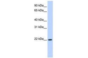 Image no. 1 for anti-Deleted in Primary Ciliary Dyskinesia Homolog (DPCD) (AA 72-121) antibody (ABIN6741298) (DPCD antibody  (AA 72-121))