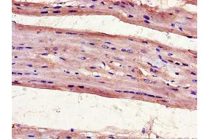 Immunohistochemistry of paraffin-embedded human heart tissue using ABIN7175097 at dilution of 1:100 (UNG antibody  (AA 114-224))
