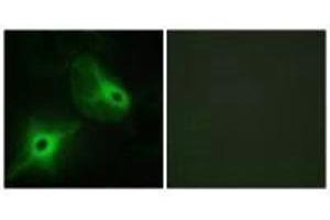 Immunofluorescence analysis of HeLa cells, using KSR2 antibody. (KSR2 antibody)