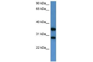 WB Suggested Anti-STYXL1 Antibody Titration: 0. (STYXL1 antibody  (Middle Region))
