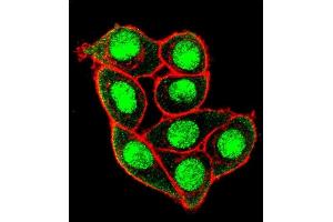 Confocal immunofluorescent analysis of Phospho-MUC1- Antibody (ABIN650864 and ABIN2839814) with Hela cell followed by Alexa Fluor 488-conjugated goat anti-rabbit lgG (green). (MUC1 antibody  (pThr1224))