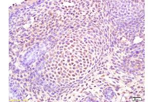 Formalin-fixed and paraffin embedded mouse embryo labeled with Rabbit Anti Osterix Polyclonal Antibody, Unconjugated (ABIN737811) at 1:200 followed by conjugation to the secondary antibody and DAB staining (SP7 antibody  (AA 331-431))