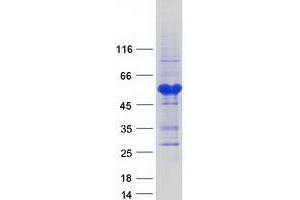 Validation with Western Blot (SAP30BP Protein (Myc-DYKDDDDK Tag))