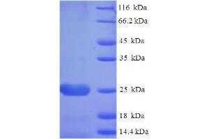 SDS-PAGE (SDS) image for Alveolar Soft Part Sarcoma Chromosome Region, Candidate 1 (ASPSCR1) (AA 23-214) protein (His tag) (ABIN5711213) (ASPSCR1 Protein (AA 23-214) (His tag))