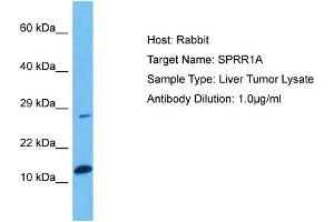 Host: Rabbit Target Name: SPRR1A Sample Tissue: Human Liver Tumor Antibody Dilution: 1ug/ml (SPRR1A antibody  (Middle Region))