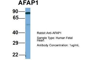 Host: Rabbit  Target Name: AFAP1  Sample Tissue: Human Fetal Heart  Antibody Dilution: 1. (AFAP antibody  (Middle Region))