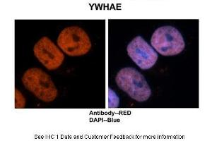 Sample Type :  Human brain stem cells  Primary Antibody Dilution :  1:500  Secondary Antibody :  Goat anti-rabbit Alexa-Fluor 594  Secondary Antibody Dilution :  1:1000  Color/Signal Descriptions :  Ywhae: Red DAPI:Blue  Gene Name :  Ywhae  Submitted by :  Dr. (YWHAE antibody  (C-Term))