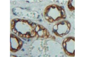 Used in DAB staining on fromalin fixed paraffin-embedded Kidney tissue (IL-10RA antibody  (AA 17-241))