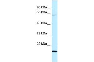 WB Suggested Anti-DNAJC11 Antibody Titration: 1.