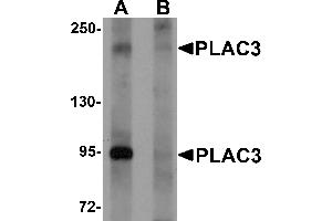 Western Blotting (WB) image for anti-Pappalysin 2 (PAPPA2) (N-Term) antibody (ABIN1031518)
