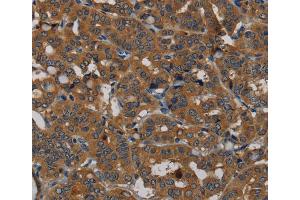 Immunohistochemistry (IHC) image for anti-phosphodiesterase 5A, cGMP-Specific (PDE5A) antibody (ABIN2433559) (PDE5A antibody)