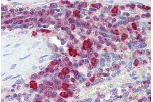 Human Spleen (formalin-fixed, paraffin-embedded) stained with PIM3 antibody ABIN462148 followed by biotinylated goat anti-rabbit IgG secondary antibody ABIN481713, alkaline phosphatase-streptavidin and chromogen. (PIM3 antibody  (AA 259-288))