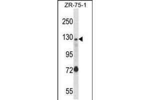 Western blot analysis in ZR-75-1 cell line lysates (35ug/lane). (UBE4A antibody  (AA 451-479))