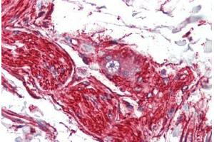 Human Nerve and Ganglion Cell (formalin-fixed, paraffin-embedded) stained with S100A10 antibody ABIN462133 followed by biotinylated anti-mouse IgG secondary antibody ABIN481714, alkaline phosphatase-streptavidin and chromogen. (S100A10 antibody)