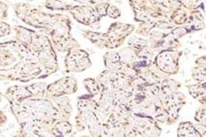 Immunohistochemistry (Paraffin-embedded Sections) (IHC (p)) image for anti-Sad1 and UNC84 Domain Containing 2 (SUN2) antibody (ABIN7075502)