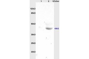 SDS-PAGE (SDS) image for anti-Homeobox A10 (HOXA10) (AA 311-410) antibody (ABIN741195)