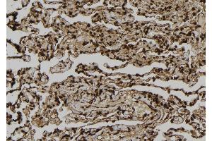 ABIN6277015 at 1/100 staining Human lung tissue by IHC-P. (Dystonin antibody  (C-Term))