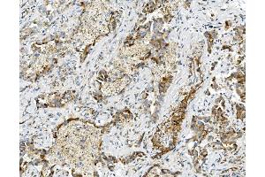 IHC analysis of USP16 using anti-USP16 antibody (ABIN7602640). (USP16 antibody  (AA 9-823))