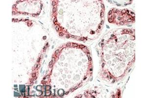 ABIN870640 (5µg/ml) staining of paraffin embedded Human Thyroid Gland. (Thyroperoxidase antibody  (Internal Region))