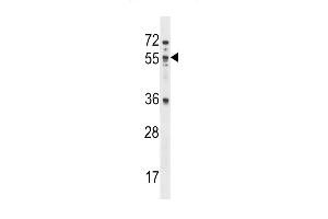 MEX3B Antibody (N-term) (ABIN1539323 and ABIN2848499) western blot analysis in NCI- cell line lysates (35 μg/lane). (MEX3B antibody  (N-Term))