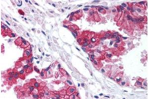 Human Prostate (formalin-fixed, paraffin-embedded) stained with TMED10 antibody ABIN214004 at 5 ug/ml followed by biotinylated goat anti-rabbit IgG secondary antibody ABIN481713, alkaline phosphatase-streptavidin and chromogen. (TMED10 antibody  (Internal Region))