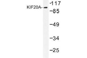 Image no. 1 for anti-Kinesin Family Member 20A (KIF20A) antibody (ABIN317796) (KIF20A antibody)
