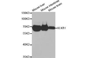 Western blot analysis of extracts of various cell lines, using KLKB1 antibody (ABIN2975433) at 1/1000 dilution. (KLKB1 antibody)