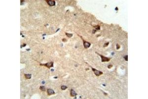 Immunohistochemistry (IHC) image for anti-FYN Oncogene Related To SRC, FGR, YES (FYN) (AA 1-30) antibody (ABIN3031010)