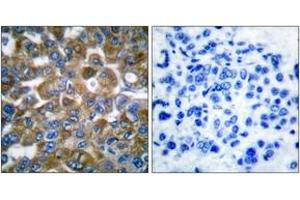 Immunohistochemistry (IHC) image for anti-Keratin 15 (KRT15) (AA 1-50) antibody (ABIN1533320)