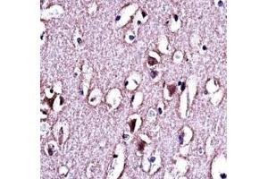 LMO2 antibody immunohistochemistry analysis in formalin fixed and paraffin embedded human brain tissue. (LMO2 antibody  (AA 1-30))