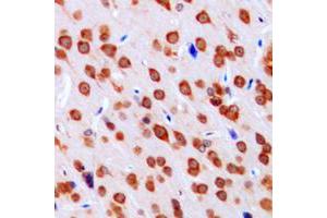 Immunohistochemical analysis of DCLK3 staining in human brain formalin fixed paraffin embedded tissue section. (DCLK3 antibody  (Center))