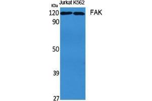 Western Blot (WB) analysis of specific cells using FAK Polyclonal Antibody. (FAK antibody  (Thr435))