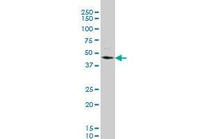 STK32C monoclonal antibody (M03), clone 4D12 Western Blot analysis of STK32C expression in NIH/3T3 . (STK32C antibody  (AA 1-369))