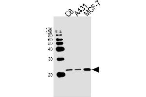 Lane 1: C6 Cell Lysates, Lane 2: A431 Cell Lysates, Lane 3: MCF-7 Cell Lysates, probed with NRAS (822CT17. (GTPase NRas antibody)