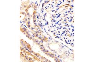 (ABIN388879 and ABIN2850431) staining USP2 in human kidney tissue sections by Immunohistochemistry (IHC-P - paraformaldehyde-fixed, paraffin-embedded sections). (USP2 antibody  (C-Term))