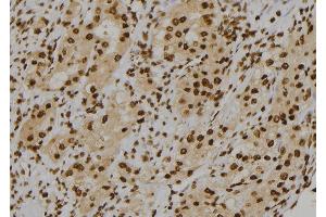 ABIN6277118 at 1/100 staining Human kidney tissue by IHC-P. (Cullin 1 antibody)
