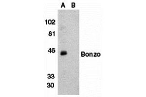 Western Blotting (WB) image for anti-Chemokine (C-X-C Motif) Receptor 6 (CXCR6) (N-Term) antibody (ABIN1031691) (CXCR6 antibody  (N-Term))