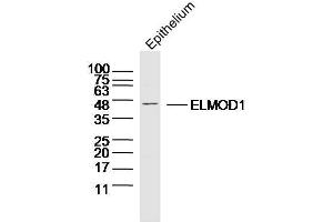 Mouse epithelium probed with ELMOD1 Polyclonal Antibody, Unconjugated  at 1:300 overnight at 4˚C.