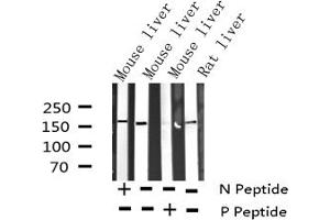 Western blot analysis of Phospho-EGFR (Thr693) expression in various lysates