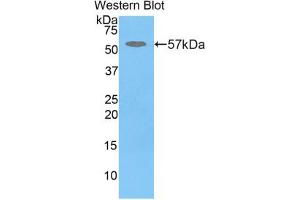 Western blot analysis of the recombinant protein. (GBA antibody  (AA 248-508))