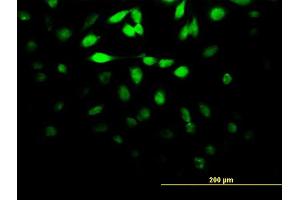 Immunofluorescence of monoclonal antibody to DUSP5 on HeLa cell. (DUSP5 antibody  (AA 286-384))