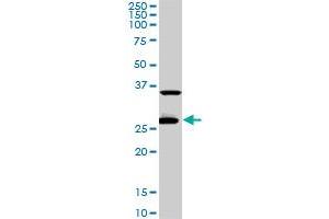 CITED1 monoclonal antibody (M02), clone 6C1. (CITED1 antibody  (AA 94-193))