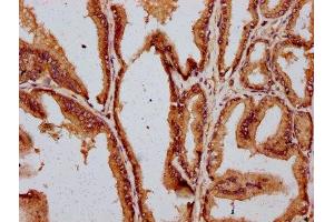 IHC image of ABIN7149497 diluted at 1:400 and staining in paraffin-embedded human prostate tissue performed on a Leica BondTM system. (DAZAP2 antibody  (AA 1-168))