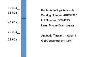 Western Blotting (WB) image for anti-Sedoheptulokinase (SHPK) (Middle Region) antibody (ABIN2785956) (SHPK antibody  (Middle Region))