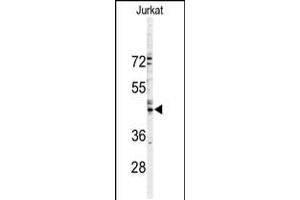 Western blot analysis of GJA3 Antibody in Jurkat cell line lysates (35ug/lane)